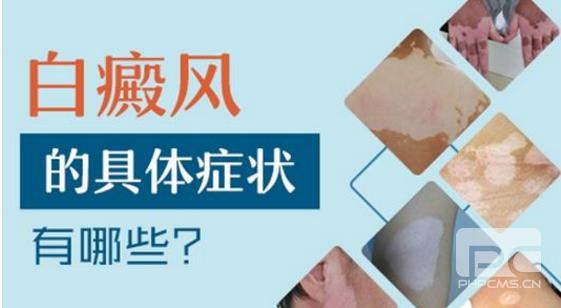 白癜风早期如何判断